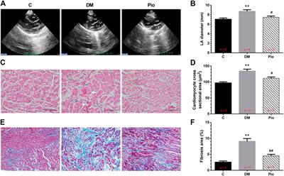 Pioglitazone Inhibits Diabetes-Induced Atrial Mitochondrial Oxidative Stress and Improves Mitochondrial Biogenesis, Dynamics, and Function Through the PPAR-γ/PGC-1α Signaling Pathway